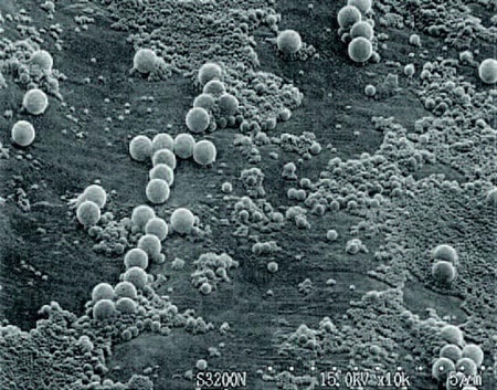 Figure 5: Electron microscopic image
